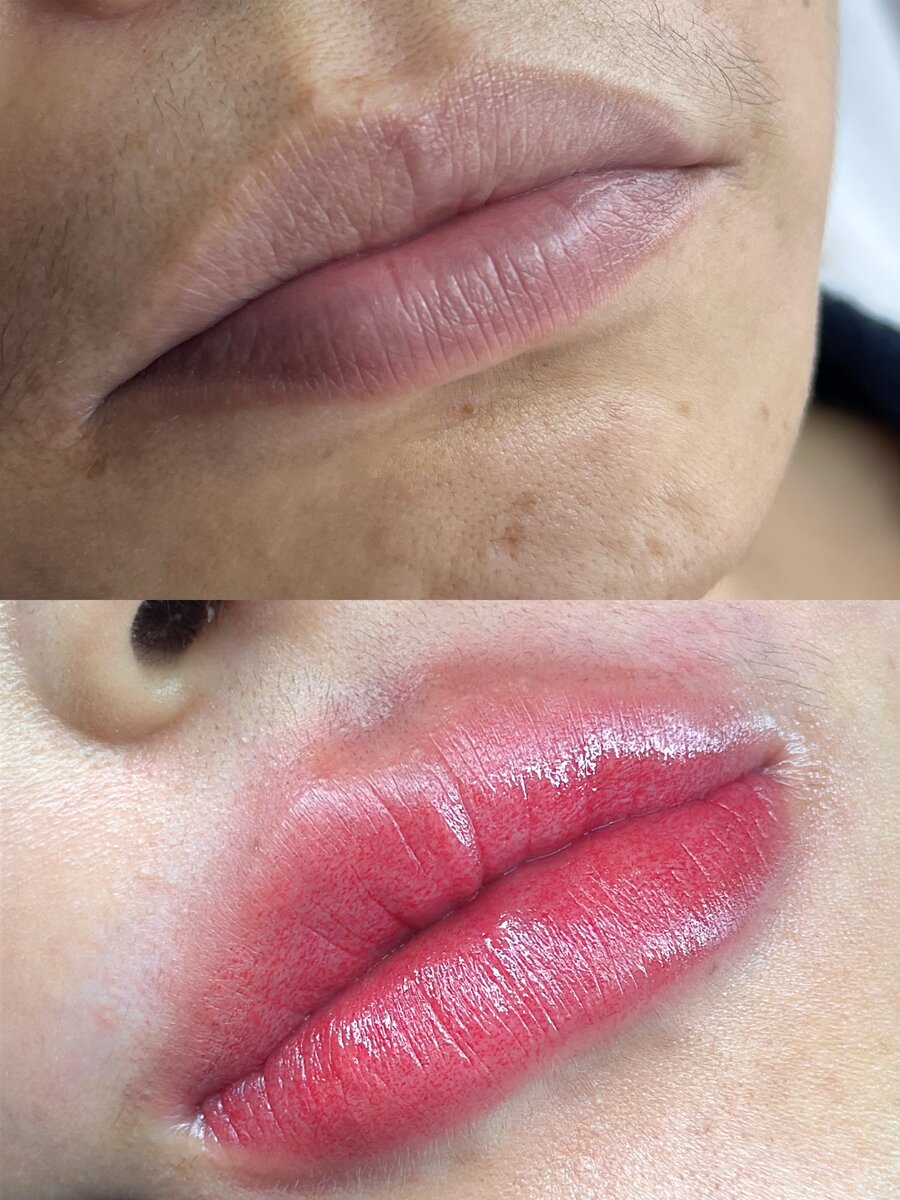 Professional lip blush enhancement Melbourne - defined lip borders