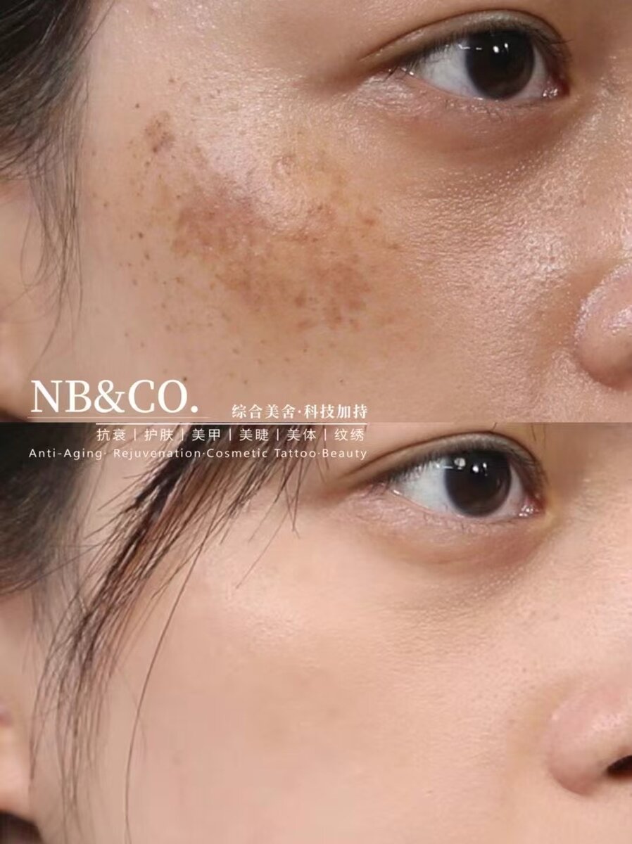 Lumecca 6 sessions results Melbourne