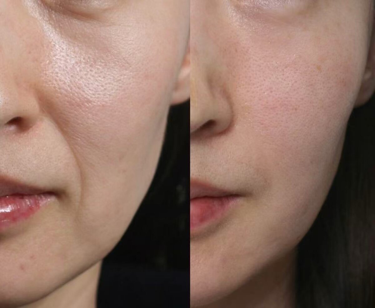 Youthful Radiance & Even Texture