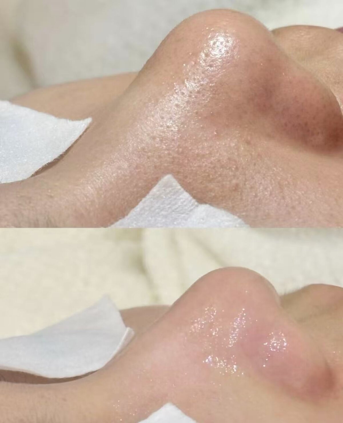 Refined Pores & Clearer Complexion