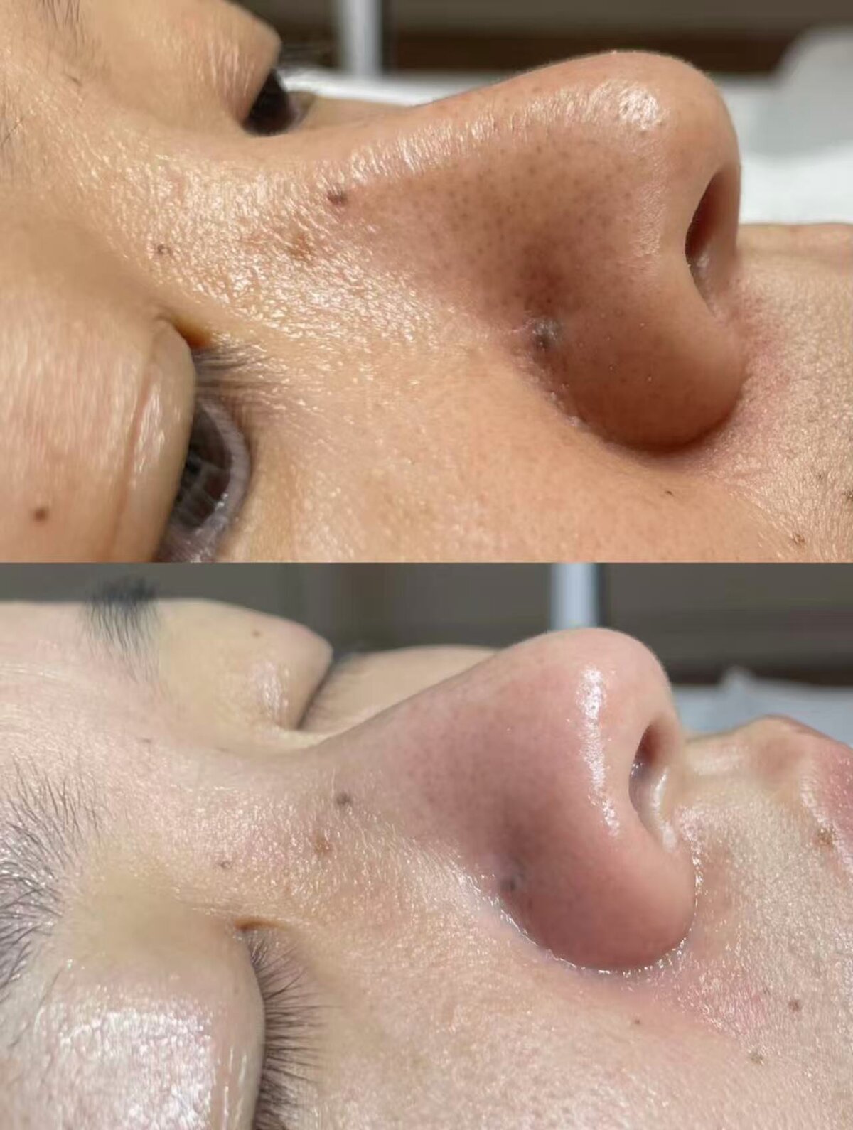 Deep Purification & Enhanced Radiance