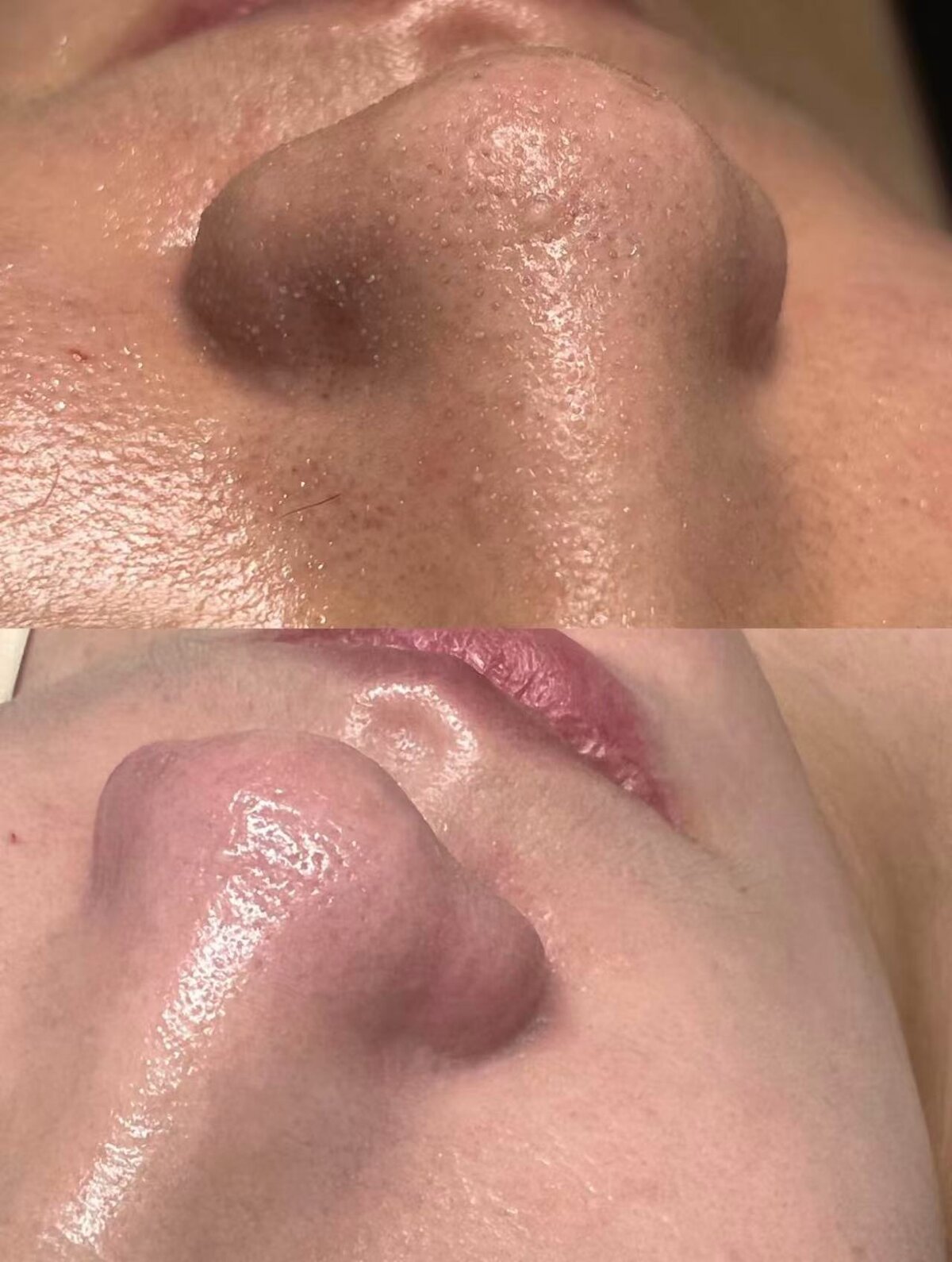 Smooth, Bright, Revitalized Skin