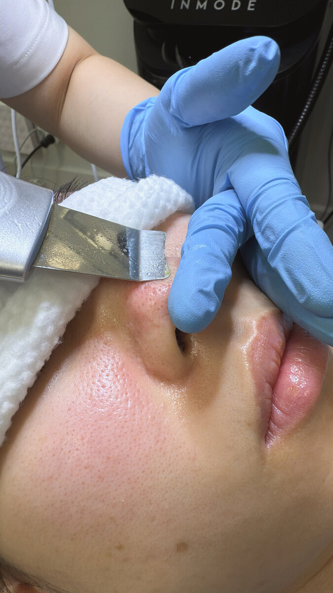 Purified & Glowing Skin