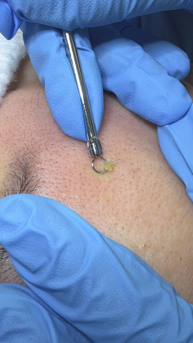 Refined Texture & Clarity