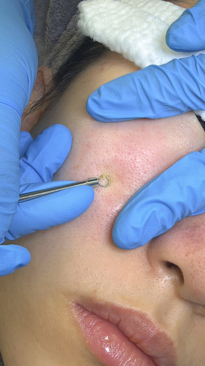 Deeply Cleansed & Revitalized