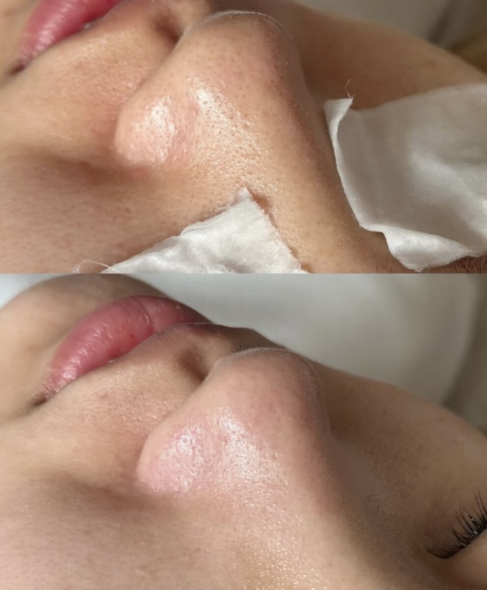 Fresh, Radiant Results