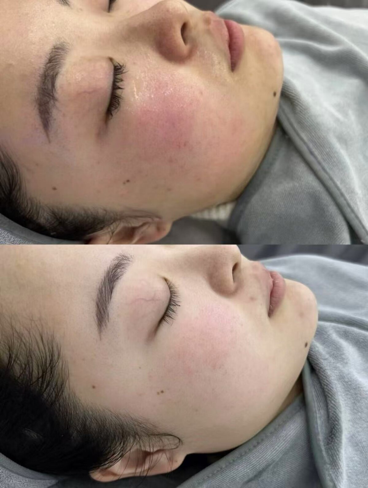 Reduced Redness & Strengthened Barrier