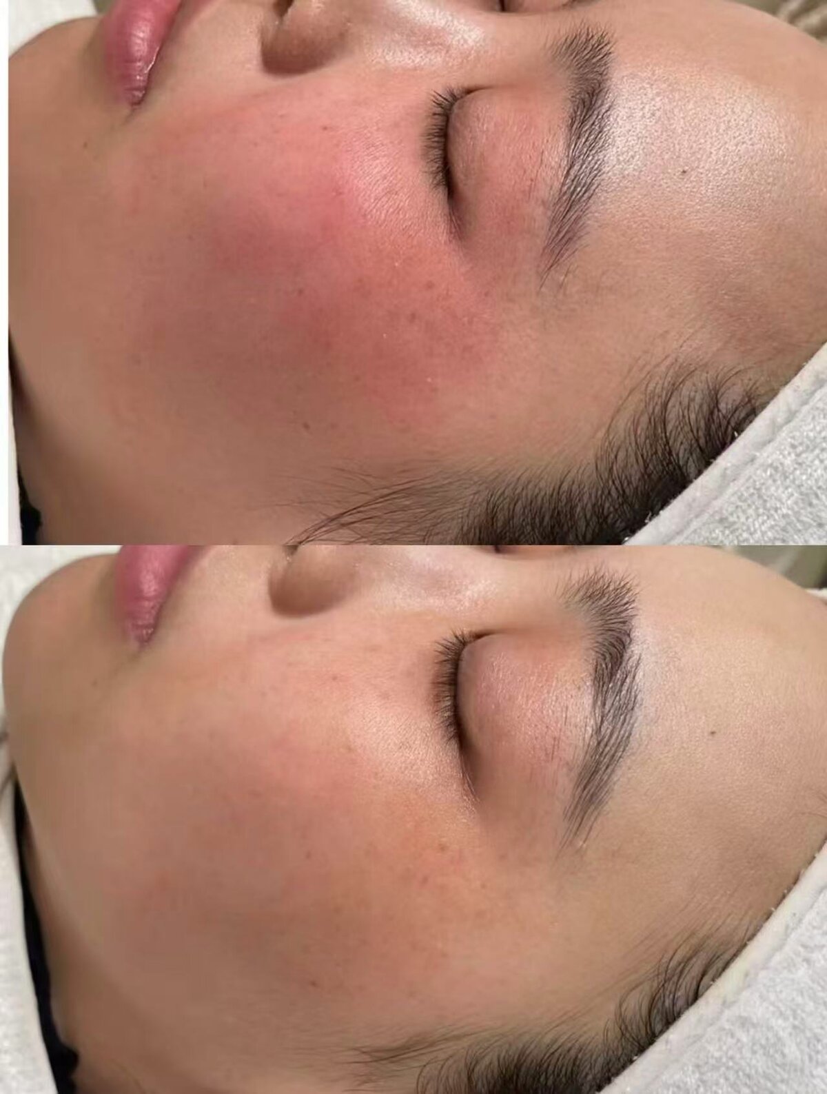 Calmed Irritation & Improved Comfort