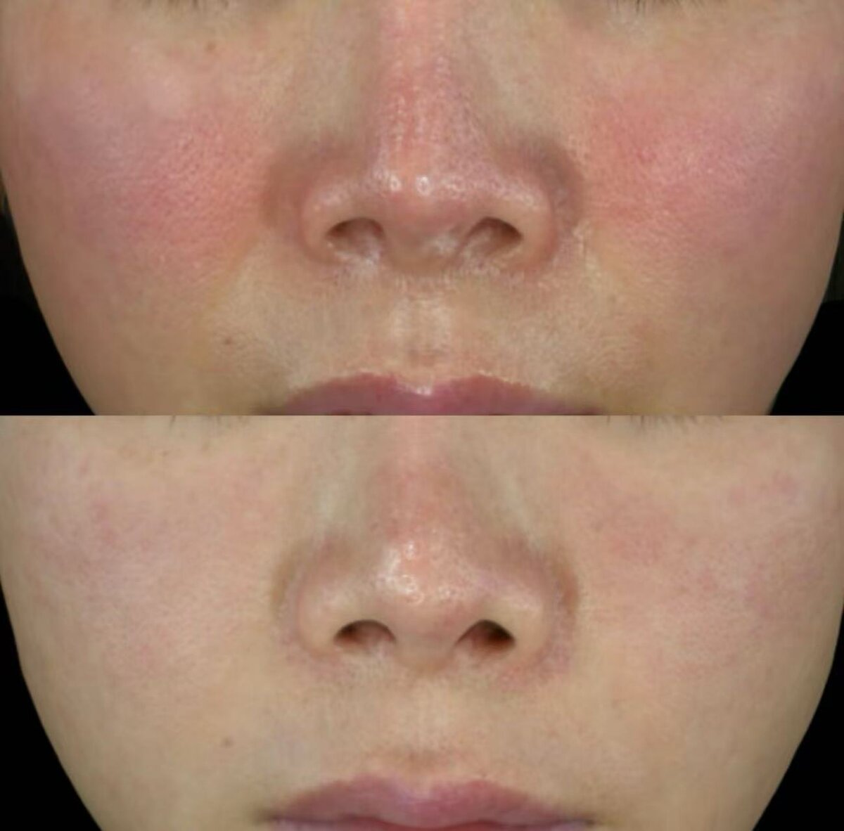 Healthier, More Resilient Skin