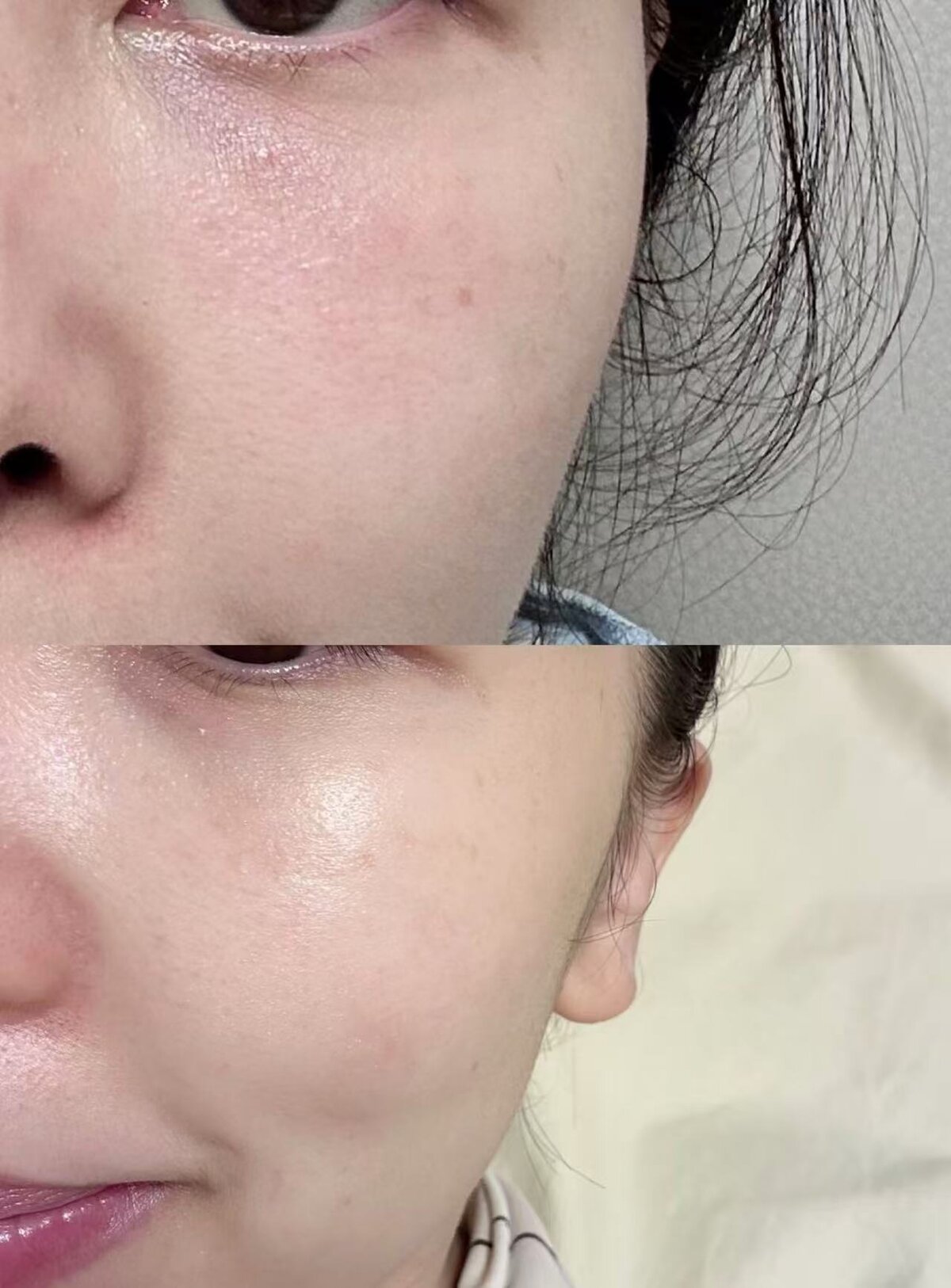 Plump, Dewy Skin Transformation