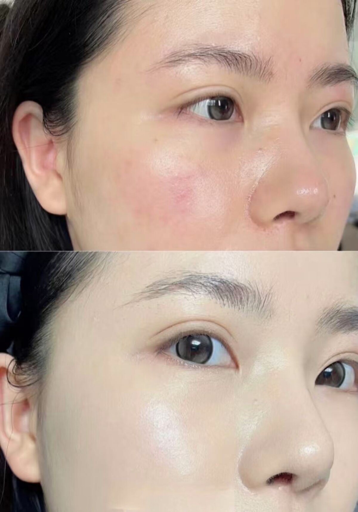 Faded Pigmentation & Luminous Glow