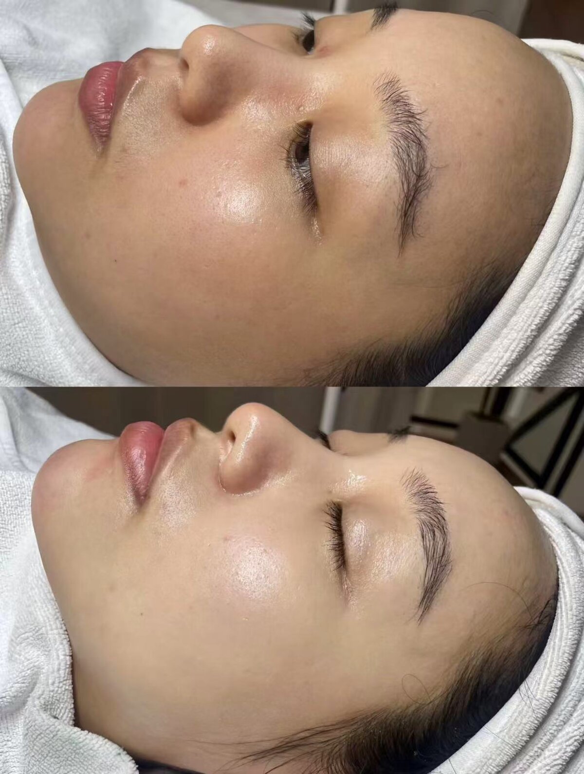 Even Tone & Enhanced Radiance