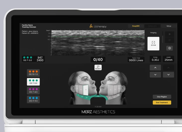 Ultherapy Prime real-time imaging visualization technology Melbourne